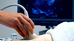 Ultrasound Services